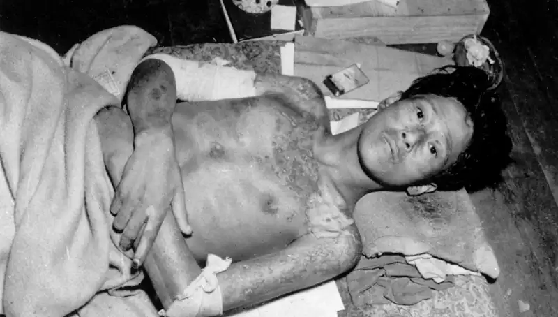 80 Yıl Sonra Nagasaki'den Tüm Dünyaya Uyarı: Nükleer Felaket Riski Artıyor!